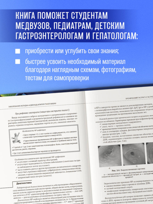 Наглядная детская гастроэнтерология и гепатология. Учебное пособие
