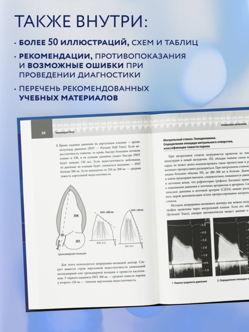 ЭхоКГ. Эхокардиография для начинающих, 2-е издание, исправленное и допол.