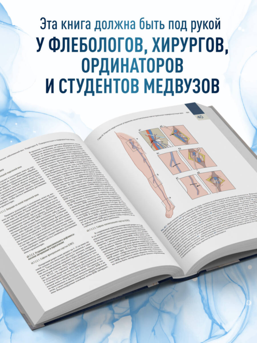 Венозные и лимфатические заболевания. Практическое руководство, 5-е издание