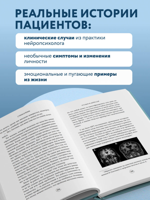 Хрупкий разум. Нейропсихолог о том, какие сбои происходят в мозге и как это меняет личность человека
