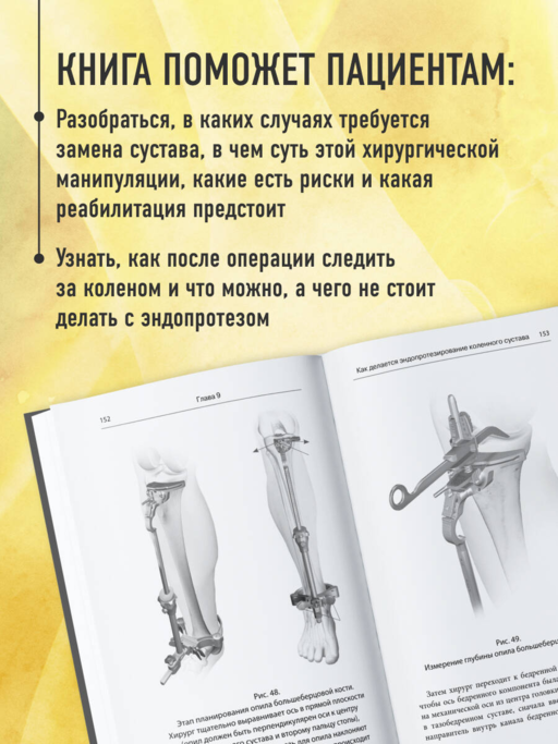 Эндопротезирование коленного сустава: ответы практикующего врача на все вопросы пациентов
