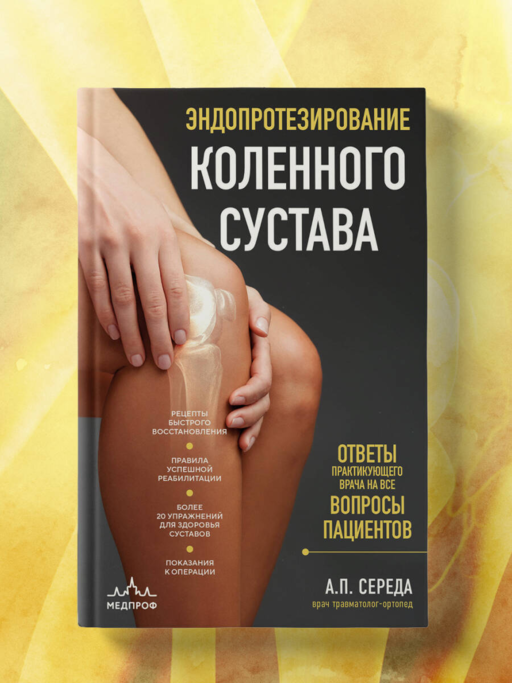 Эндопротезирование коленного сустава: ответы практикующего врача на все вопросы пациентов