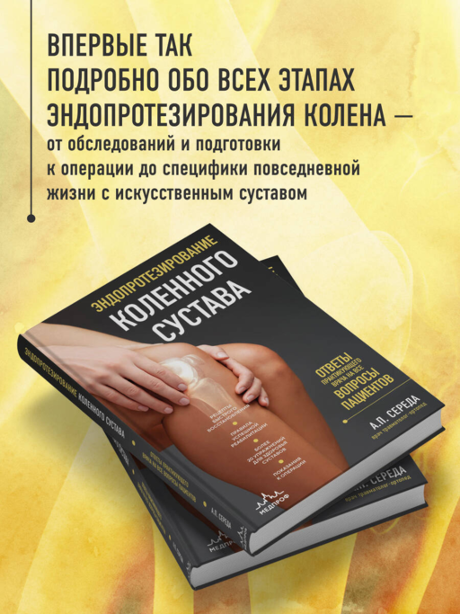 Эндопротезирование коленного сустава: ответы практикующего врача на все вопросы пациентов